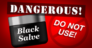 FDA warning that black salve is dangerous