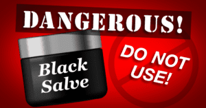 Black-Salve-Dangerous_Sept-2020 FDA warning that black salve is dangerous