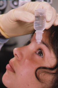 A gloved hand holding container of eye drops above a child's eye